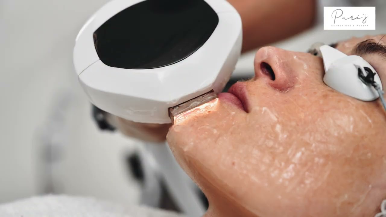 IPL Photofacial in Prosper, TX | Recovery & Skin Care Guide