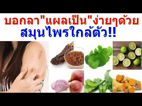 บอกลา"แผลเป็น"(scar)ง่ายๆด้วย สมุนไพร(Herbal)ใกล้ตัว