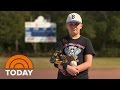 Tommy John For Teens: Why Kids Get Major League Surgery | TODAY