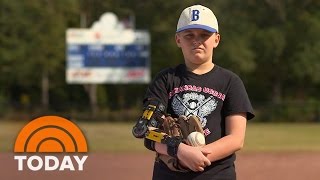 Tommy John For Teens: Why Kids Get Major League Surgery | TODAY