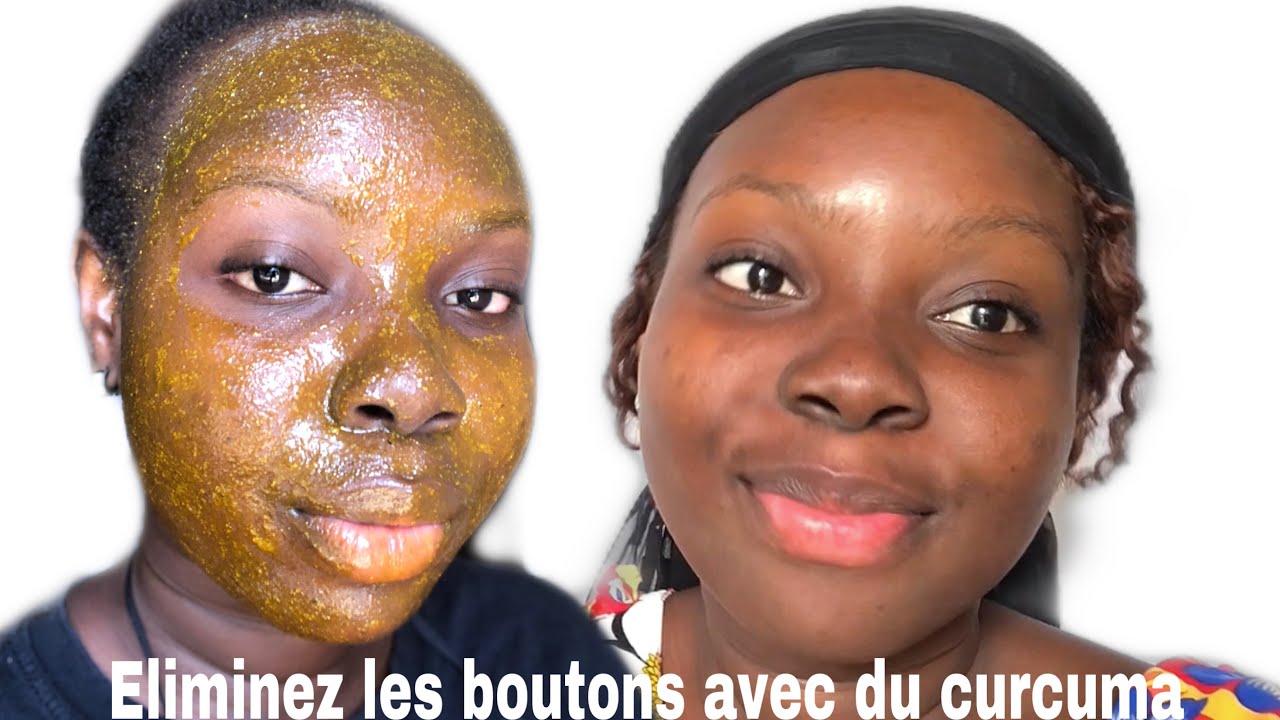 #ASTUCE 7:GOMAGE au curcuma pour enlever progressivement les cellules