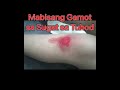 Mabisang Gamot sa Sugat lalo na sa Tuhod