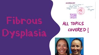 Fibrous Dysplasia l Oral pathology l Fibro Osseous lesions