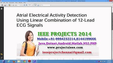Atrial Electrical Activity Detection Using Linear Combination of 12 Lead ECG Signals