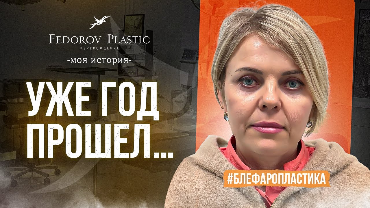 КРУГОВАЯ БЛЕФАРОПЛАСТИКА I ЛИЧНЫЙ ОПЫТ ПАЦИЕНТКИ I Видеотзыв №17 - YouTube