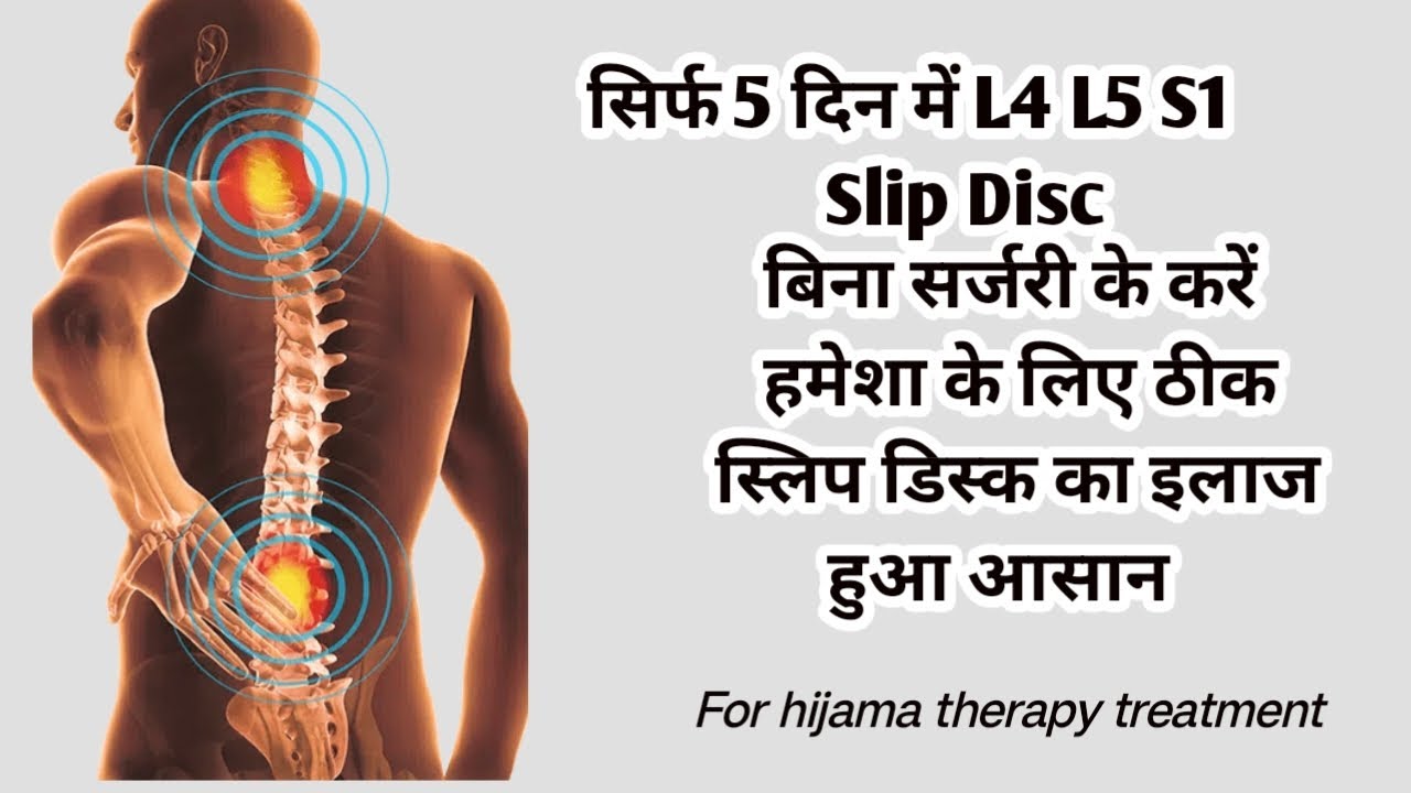 L4L5S1 disc bulge treatment YouTube