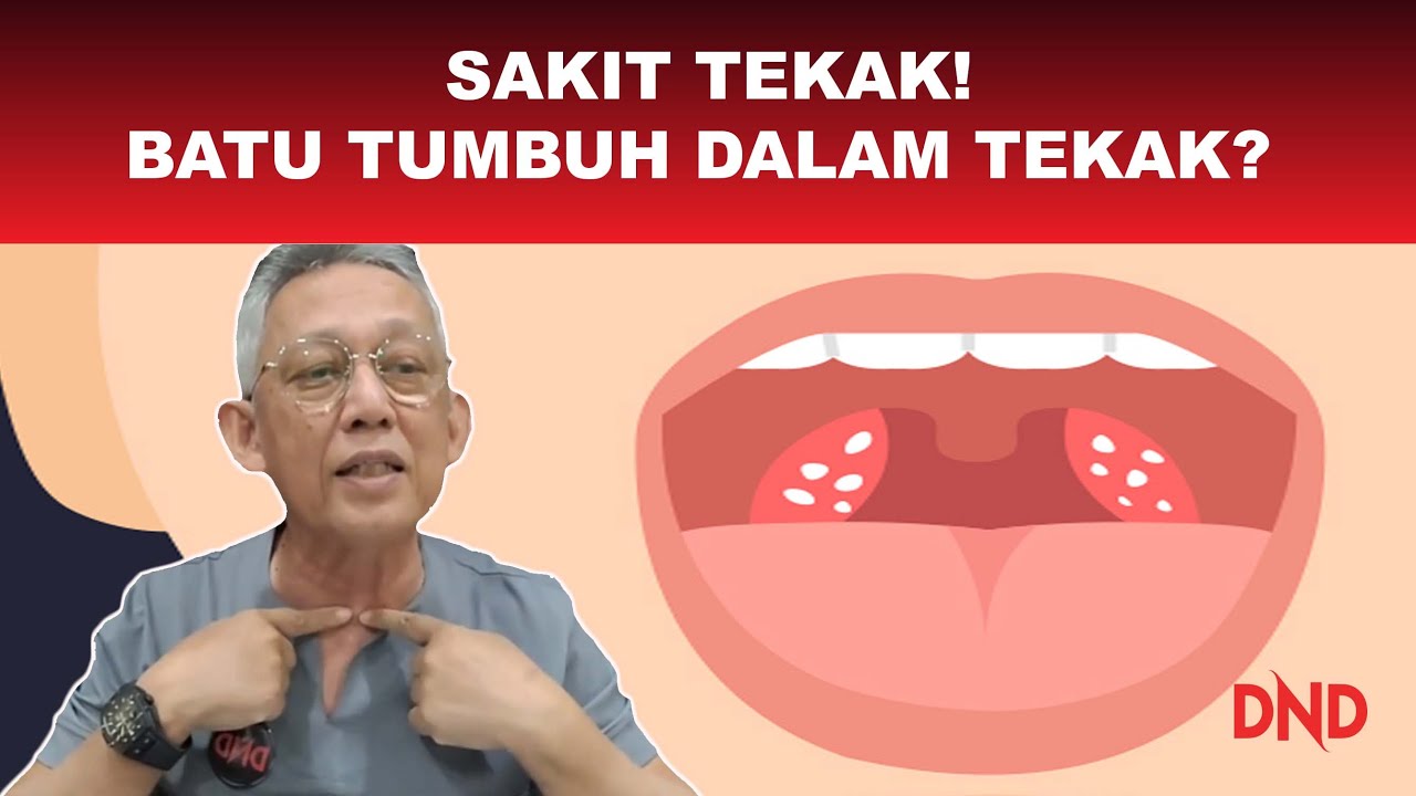 Bolehkah BATU Tumbuh dalam TEKAK? kenapa SAKIT TEKAK Berulang-ulang Kali?