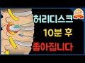 [닥터홍선생]#20.허리디스크, 10분만에 평생 좋아지도록 해드립니다.