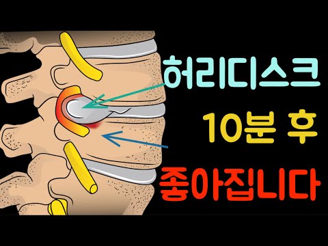 [닥터홍선생]#20.허리디스크, 10분만에 평생 좋아지도록 해드립니다.