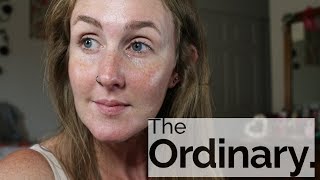 The Ordinary Skincare {MY FAVORITES}