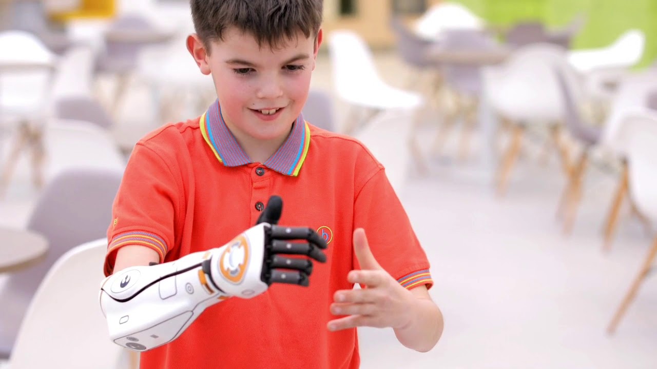 Hero Arm by Open Bionics YouTube