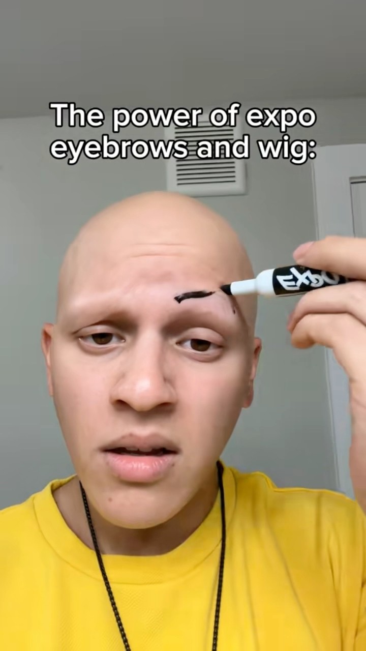 Rate me 1 to 10 in the comments #Funny #Alopecia #Lol #Comedy ￼