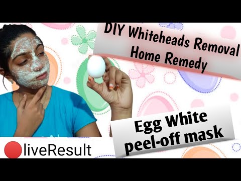 (🔴live-results)remove-blackhead&whitehead-egg-white-peel-off-mask//diy-home-remedy