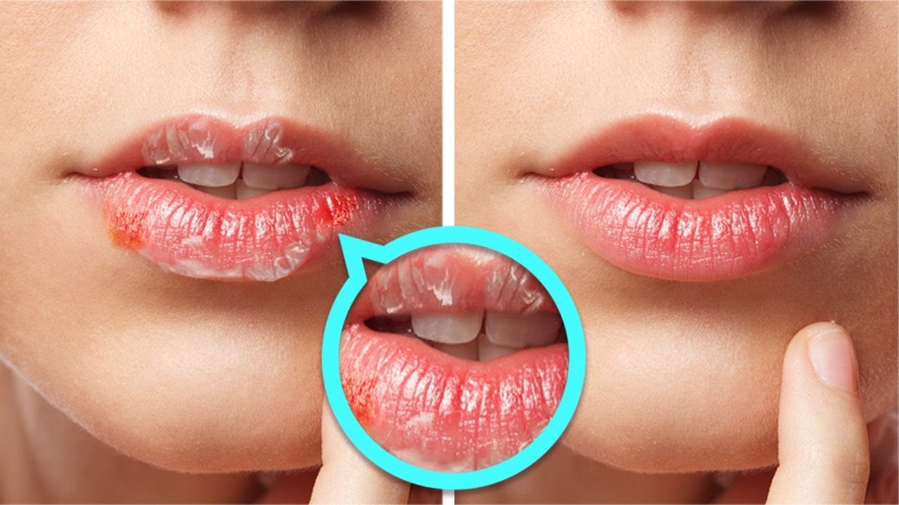 Beauty Hacks To Try At Home : 26 Priceless Beauty Hacks For Your Skin