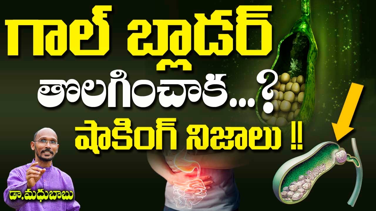 గాల్ బ్లాడర్ తొలగించాక..? షాకింగ్ నిజాలు !! | DRr. Madhu Babu | Health Trends |