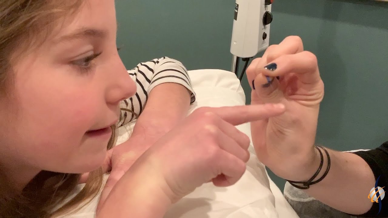 Don't be afraid of Acupuncture, if a child can do it so can you