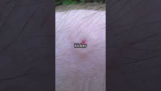 What Is A Chigger? The Tiny Pest Explained