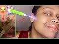 ASMR Removing Earwax with Lighted Ear Pick | Running Water 💦 #Satisfying