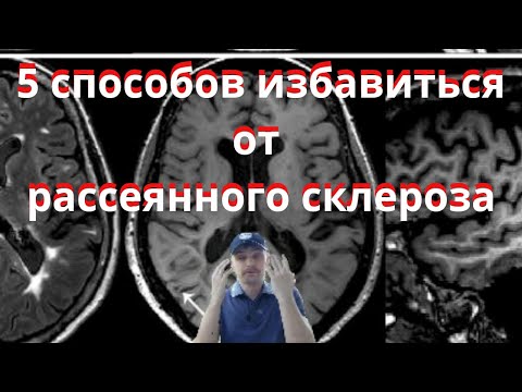 5 способов избавиться от Рассеянного склероза и другой неврологии #рс #неврология #рассеянныйсклероз