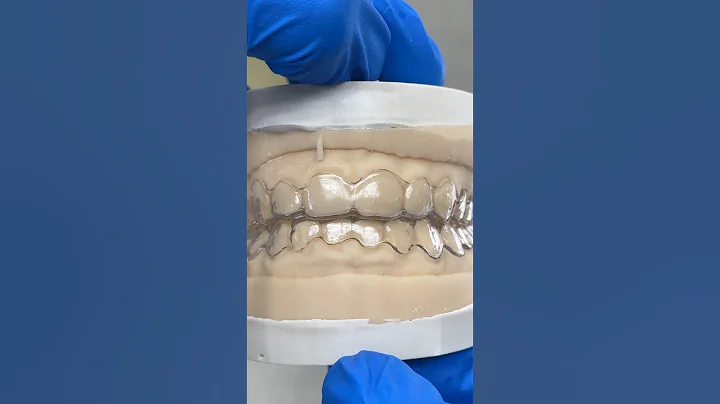 Double Essix Appliance @EnvisiontecMain #envisiontec #lsk121shorts #teeth #dental