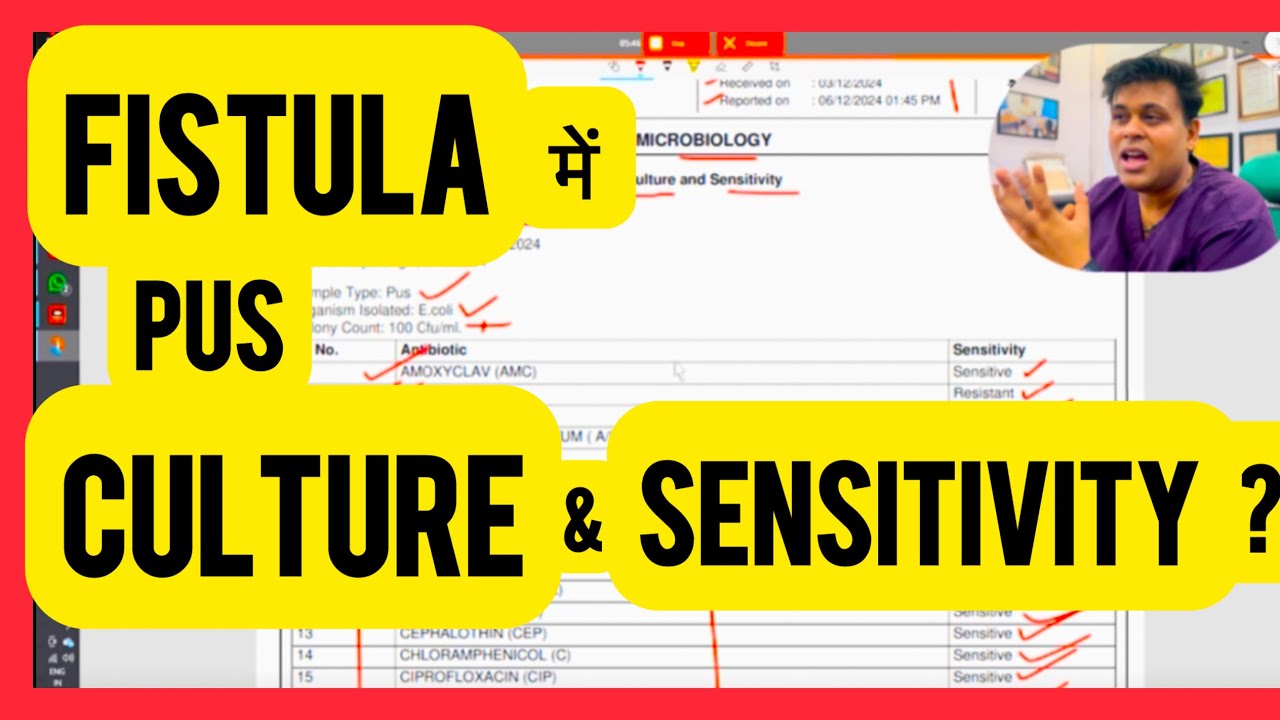 Fistula में Pus Culture और Sensitivity test क्या होता hai?  ( what is pus culture and sensitivity? )
