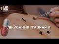 Гірудотерапія кому потрібні п явки MDExpert Гірудотерапія кому потрібні п явки MDExpert