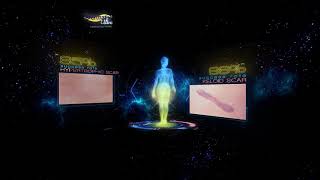 Dermatix® Ultra Advanced Scar Formula