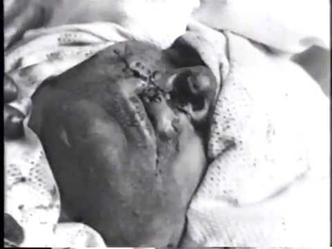閲覧注意 グロ映像あり 第一次世界大戦野戦病院ｎｈｋ映像の世紀 Youtube