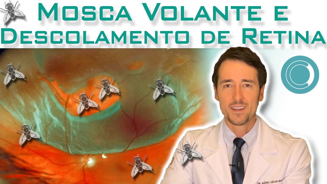 Mosca volante e descolamento de retina são a mesma coisa?