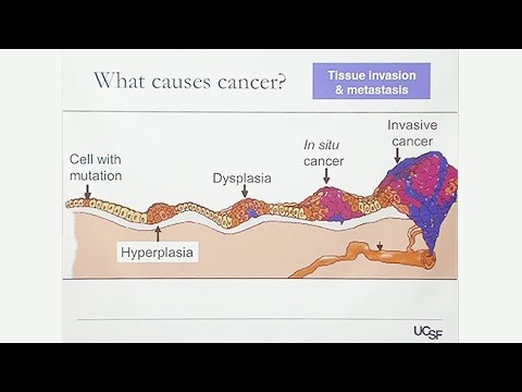 स्त्री रोग संबंधी कैंसर का अवलोकन