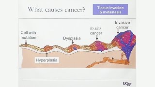 Overview of Gynecologic Cancers