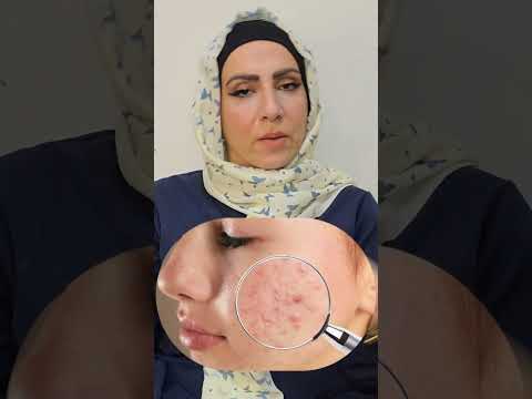 اضرار حب الريتان