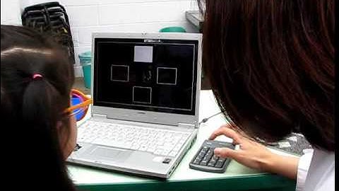 Motion Stereopsis (Binocular Depth-from-Motion, BDFM)