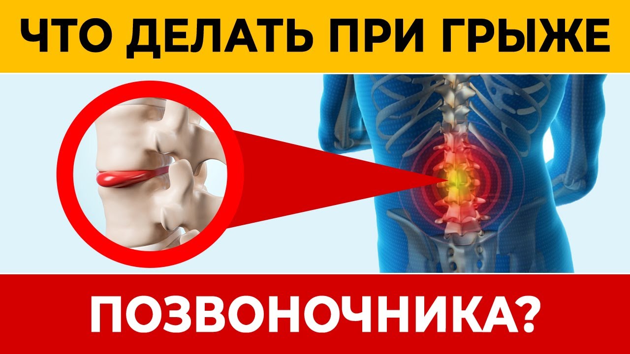 Как ИЗБАВИТЬСЯ от МЕЖПОЗВОНКОВОЙ ГРЫЖИ? Древнее китайское упражнение ...