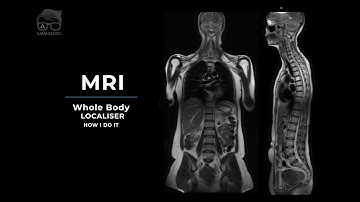 MRI – WHOLE BODY LOCALISER – How I Do It