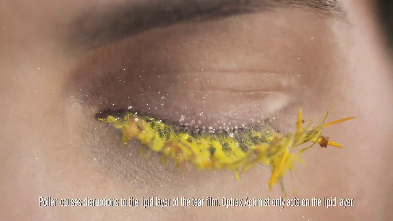 Help Relieve Itchy and Watery Eyes with Optrex - YouTube