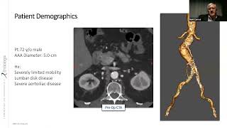 ALTO Roundtable Webinar 11/1/23 - MM2735-US Rev 01