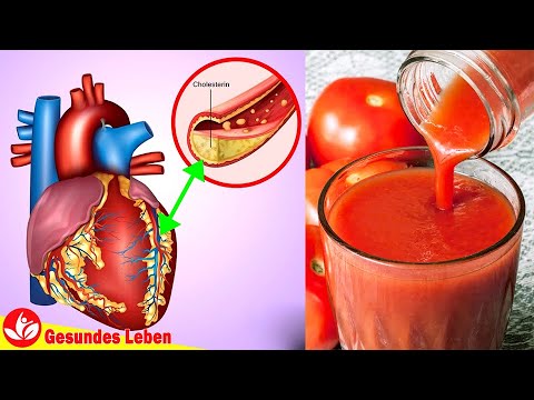 Video: Warum Ist Tomatensaft Nützlich?