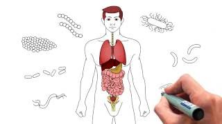 O que você sabe sobre Sepse?