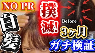 【白髪日記】市販品だけで3ヶ月、白髪撲滅検証したけどすごかった!