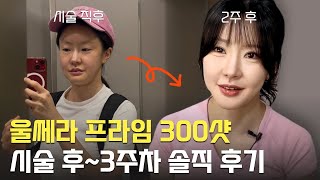 외모는 울쎄라로 업그레이드😀 마음은 타로로 정리하기🔮