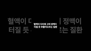 혹시 나도 하지정맥류? 방치하지마세요!