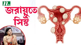 ওভারিয়ান সিস্ট কী? এর লক্ষণ ও উপসর্গ। ডা. জয়শ্রী সাহার পরামর্শ Shastho Protidin স্বাস্থ্য প্রতিদিন