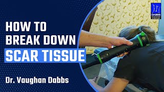 Break Down SCAR TISSUE with Rapid Release & Shockwave Therapy: Faster Recovery - Columbia MD