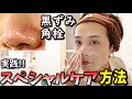 【黒ずみ 角栓】本気で毛穴なくしたい人はこの動画を真似するだけ！