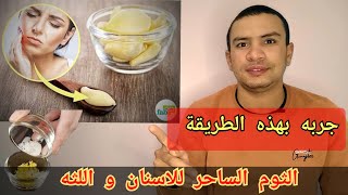 اسرار الثوم التي يخفيها عنك الاطباء لعلاج الم الضرس و خراج الاسنان و تراجع اللثه