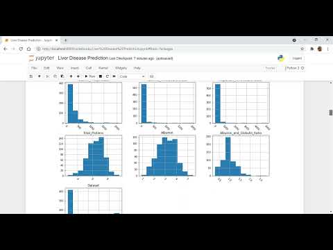Liver Disease Prediction