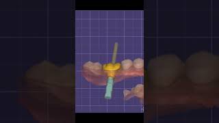 EXOCAD  download free