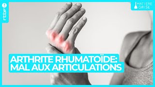 Arthrite rhumatoïde : avoir mal aux articulations n'est pas qu'une question d'âge - Matière Grise