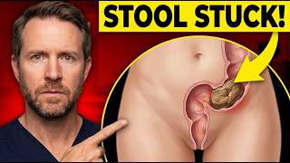 This Everyday Habit Causes Stool Stuck in the Rectum | Doctor Warns